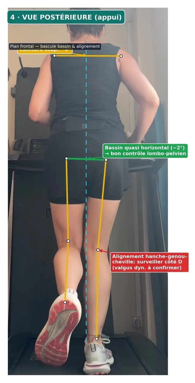 Analyse vidéo d'une course sur tapis, vue de dos : lignes d'alignement de la hanche, du genou et de la cheville, bascule du bassin